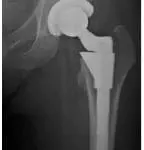 knee joint