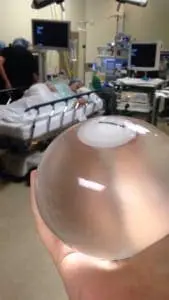 Dr. Curry's First Orbera Intra-Gastric Weight Loss Balloon Patient