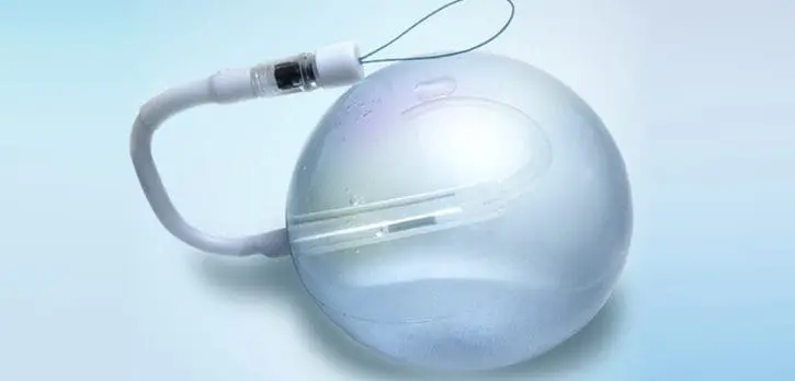 spatz 3 adjustable gastric balloon