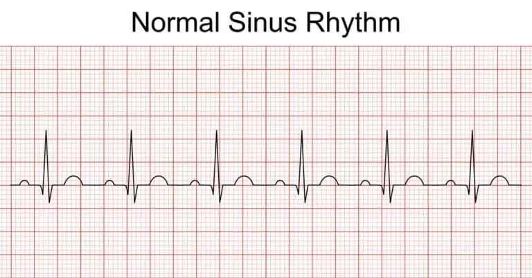 12 lead ekg