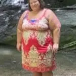 pre-op picture of weight loss surgery patient Ann G