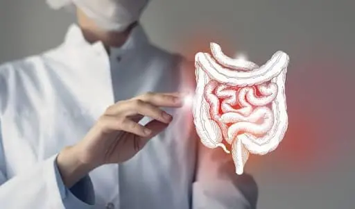 gastric sleeve requirements