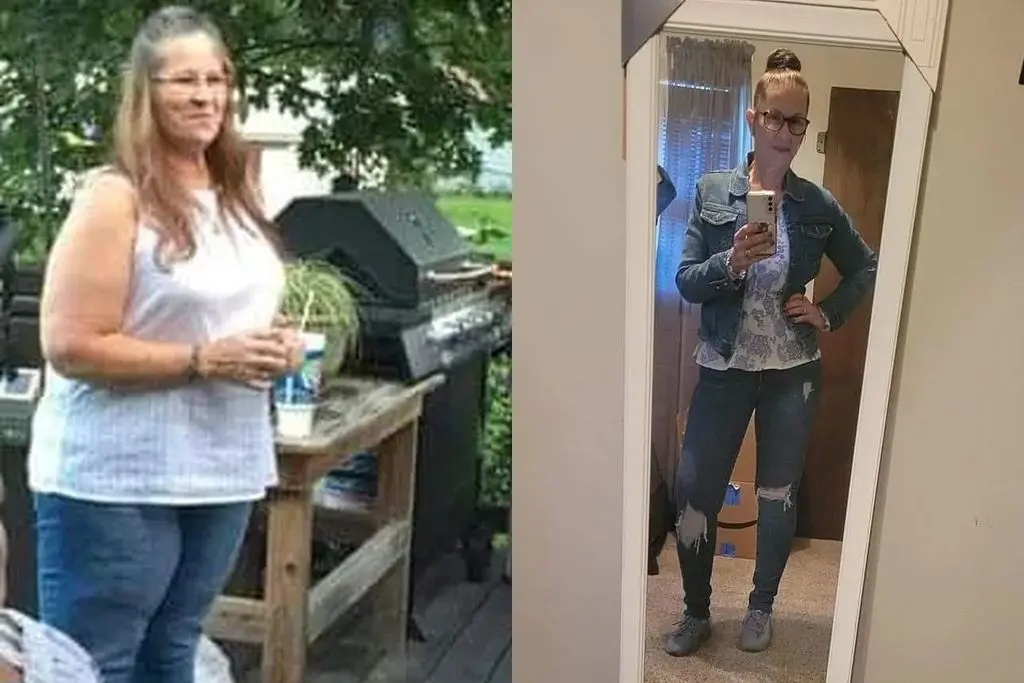 Kimberly before and after gastric sleeve surgery showing her 109-pound weight-loss result at JourneyLite