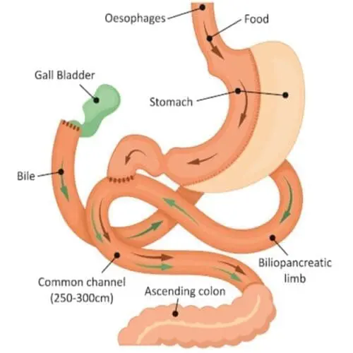 SADI/SIPS Starter Kit