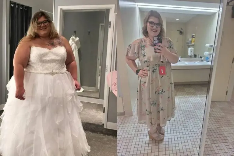 Meagan before and after gastric sleeve surgery showing her 140-pound weight-loss result at JourneyLite