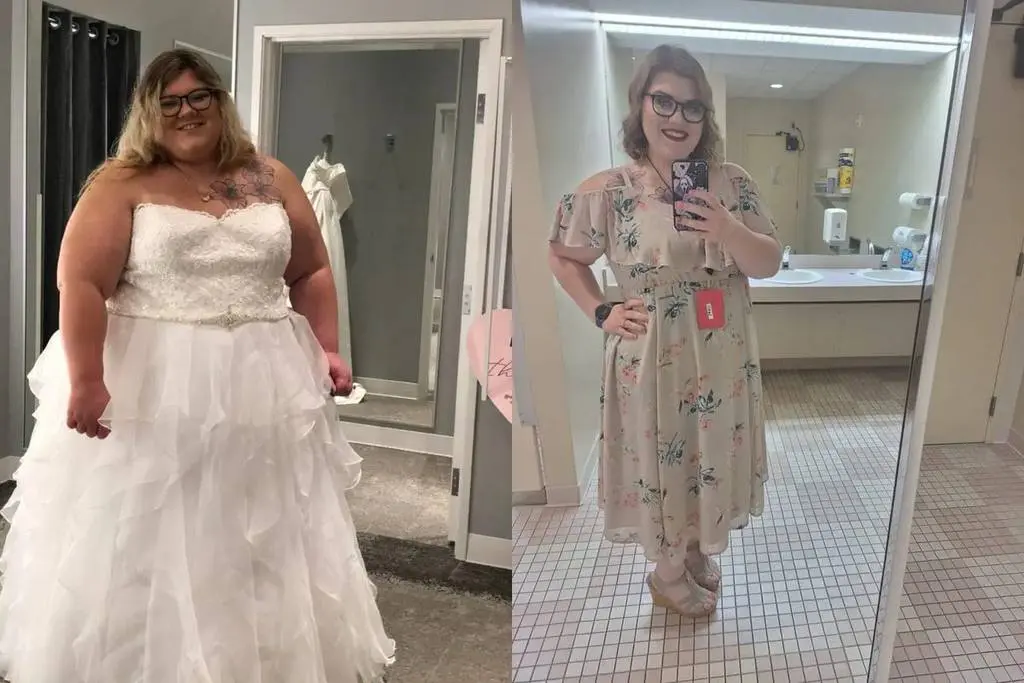 Meagan before and after gastric sleeve surgery showing her 140-pound weight-loss result at JourneyLite