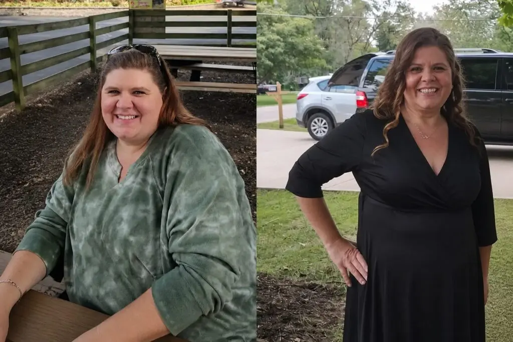 Heather before and after gastric sleeve surgery showing her 142-pound weight-loss result at JourneyLite