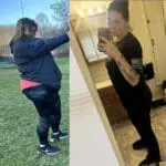 Rebeca before and after gastric sleeve surgery