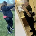 Rebeca before and after gastric sleeve surgery showing her 160-pound weight-loss result at JourneyLite