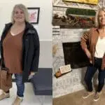 Christie's VSG before and after pictures