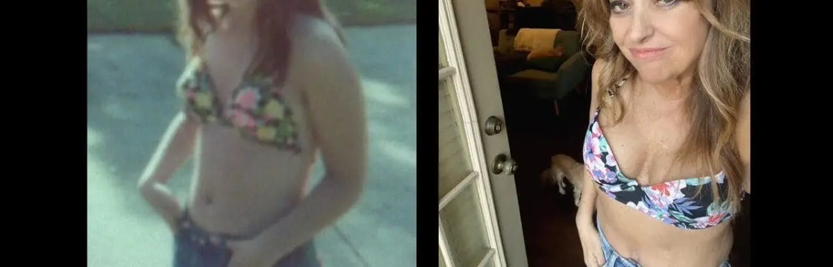 Kathi's VSG before and after story