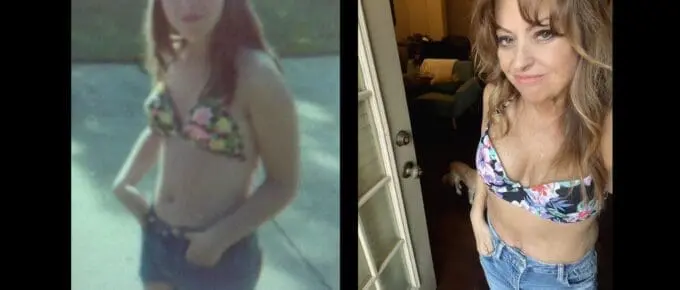 Kathi's VSG before and after story