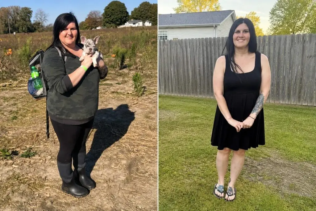 Jamie before and after gastric sleeve surgery showing her approximately 90-pound weight-loss result at JourneyLite