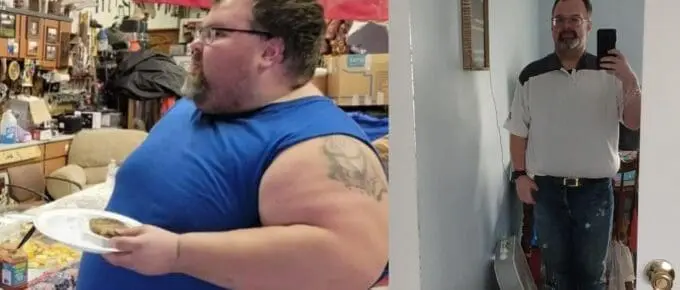 jonathon before and after gastric sleeve (VSG)