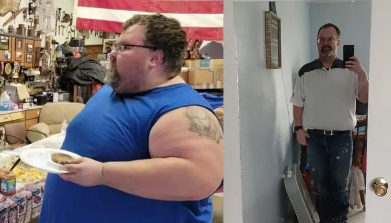 Jonathon before and after gastric sleeve surgery