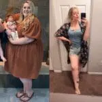 callie before and after losing 187 pounds with gastric sleeve surgery