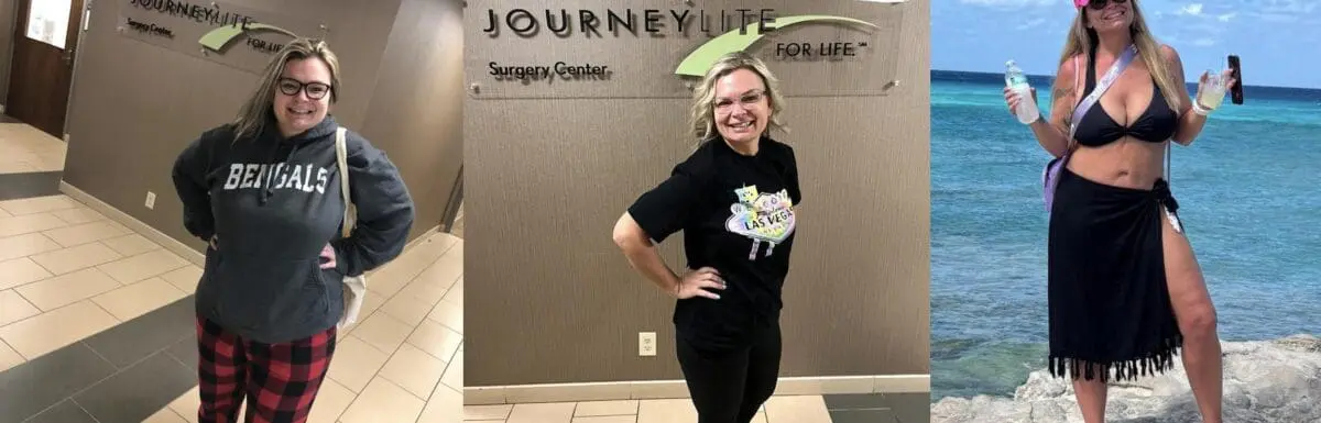 jennifer before and after vsg