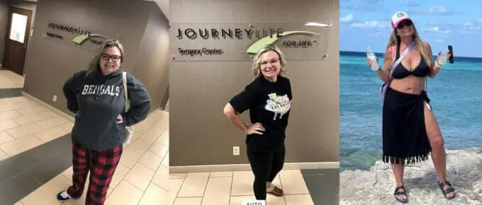 jennifer before and after vsg