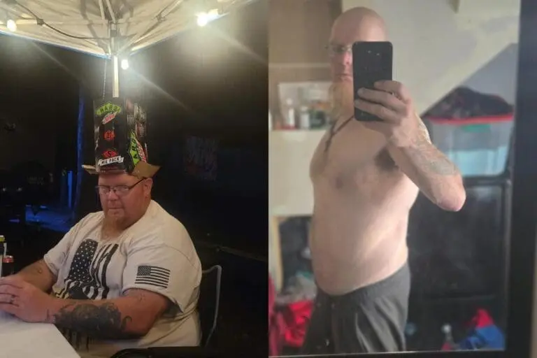 Jeremiah before and after gastric sleeve surgery