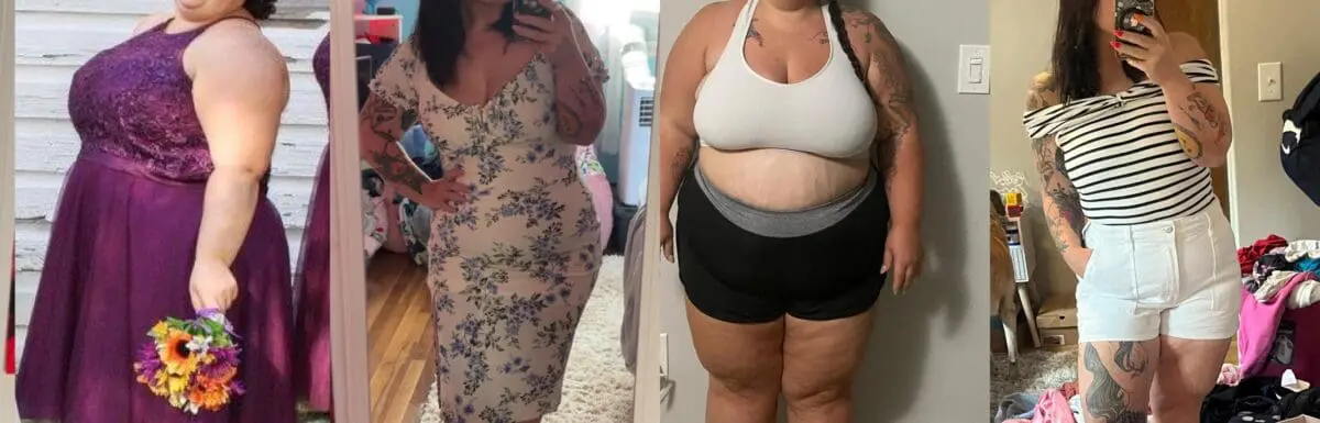 VSG before and after pictures of Kayla