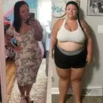 VSG before and after pictures of Kayla