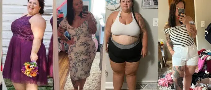 VSG before and after pictures of Kayla