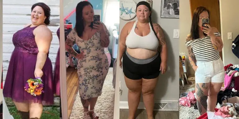 Kayla before and after gastric sleeve surgery