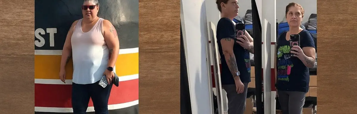 krystal before and after vsg at journeylite