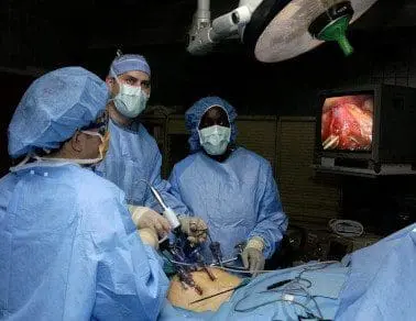 laparoscopic weight loss surgery