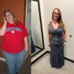 rebecca before and after vsg