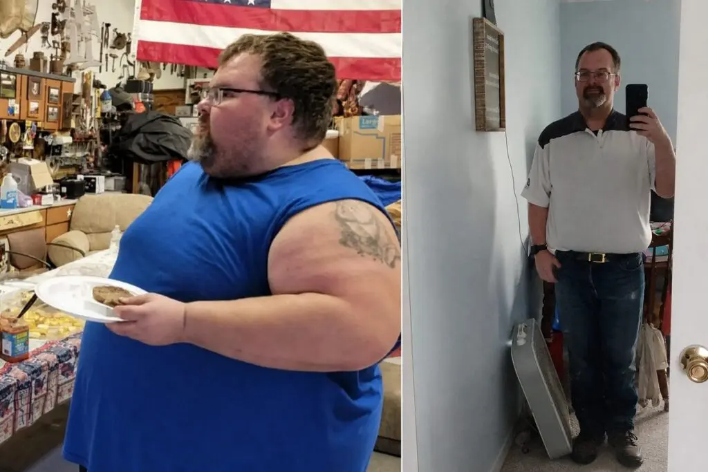 Jonathon before and after gastric sleeve surgery showing his 330-pound weight-loss result at JourneyLite