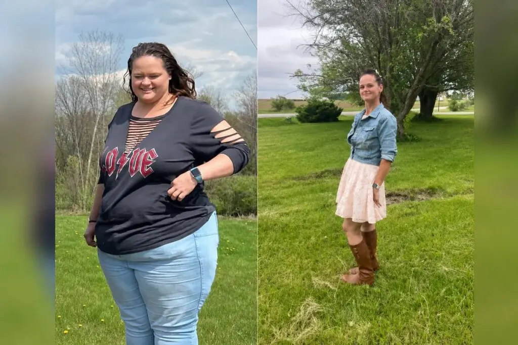 Kristin before and after gastric bypass surgery showing her 210-pound weight-loss result at JourneyLite