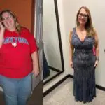 Rebecca before and after gastric sleeve surgery showing her 136-pound weight-loss result at JourneyLite