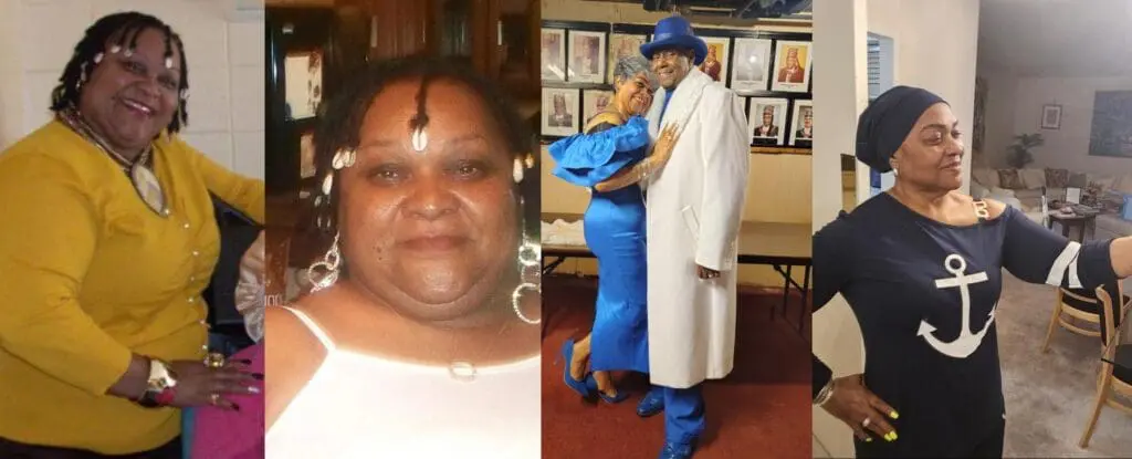 Audrey before and after gastric sleeve surgery