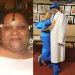 audrey before and after gastric sleeve (vsg) at journeylite