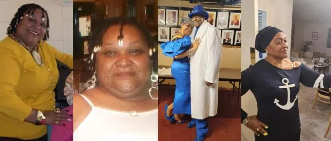 audrey before and after gastric sleeve (vsg) at journeylite