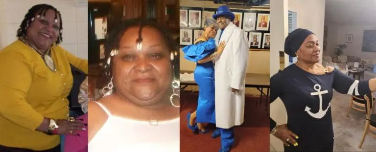 Audrey before and after gastric sleeve surgery
