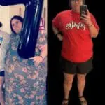 Mindy's JourneyLite VSG before and after picture