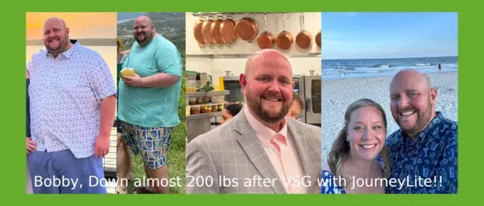 Bobby's vsg before and after collage