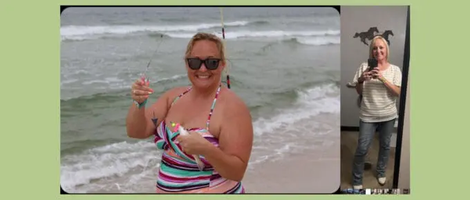 Kandace vsg before and after pictures