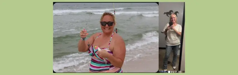Kandace before and after gastric sleeve surgery