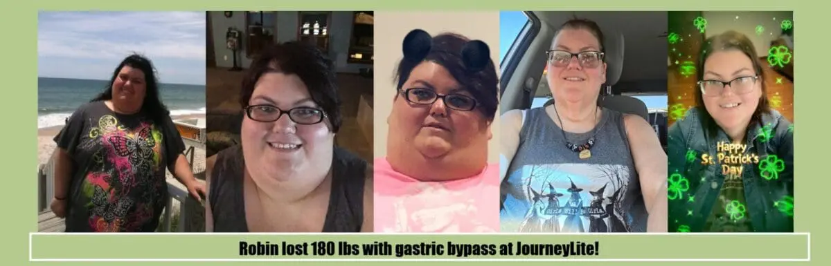 Wide before-and-after photo collage of Robin’s gastric bypass weight loss journey, showing several pre-surgery images on the left and healthier, slimmer post-surgery images on the right after treatment with Dr. James Augusta at JourneyLite.