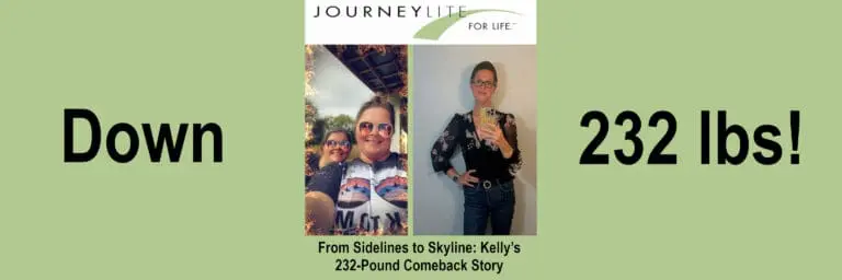 Kelly before and after weight loss surgery
