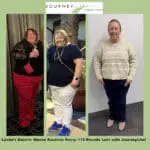 Leslie’s three-panel before-and-after photo showing her 112-pound weight loss after gastric sleeve surgery with Dr. James Augusta at JourneyLite Surgery Center.