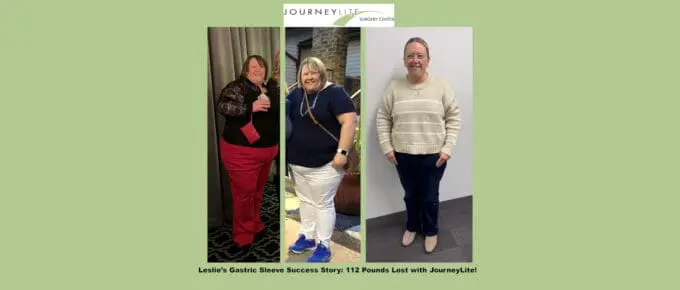 Leslie’s three-panel before-and-after photo showing her 112-pound weight loss after gastric sleeve surgery with Dr. James Augusta at JourneyLite Surgery Center.