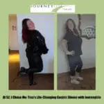 Side-by-side before-and-after photo of Tina, a JourneyLite gastric sleeve patient, showing her weight loss and increased confidence as she poses in a sparkly black outfit and fitted athletic wear after surgery with Dr. James Augusta at JourneyLite