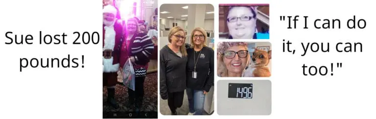 Christie before and after gastric sleeve surgery