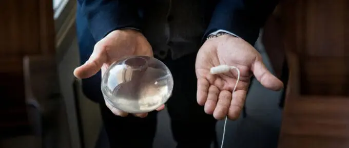 A person's hands holding a clear, inflated spherical gastric balloon in one hand and its uninflated, swallowable white capsule form with an attached thin tube in the other.
