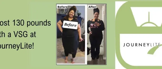 Graphic with green background reading “Robin lost 130 pounds with a VSG at JourneyLite!” beside a before-and-after photo collage and a JourneyLite scale logo.