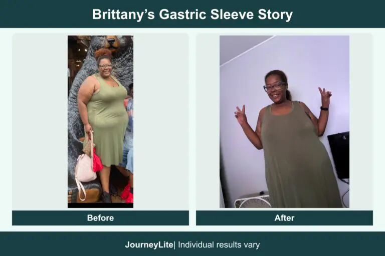 Brittany before and after gastric sleeve surgery, using patient-submitted photos